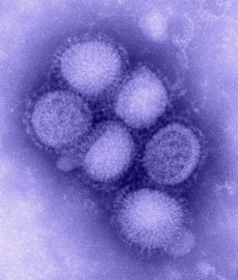 This is a microscopic version of what a strain of influenza looks like. While looking small, the flu is capable of being a powerful disease, and even taking lives in extreme cases without the vaccination.